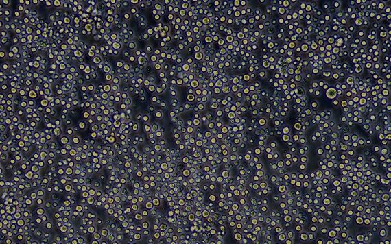 Primary Rabbit Bone Marrow Mononuclear Cells (BMMC)