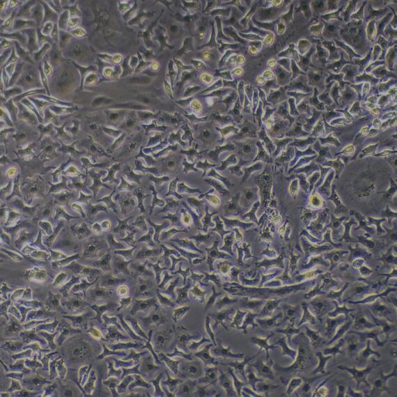 Primary Mouse Hepatic Macrophages (HM)