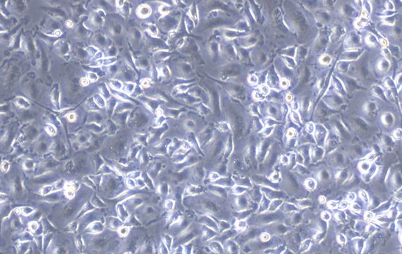 Primary Rat Hepatic Macrophages (HM)