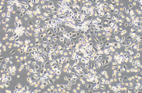 Primary Rabbit Hepatic Macrophages (HM)