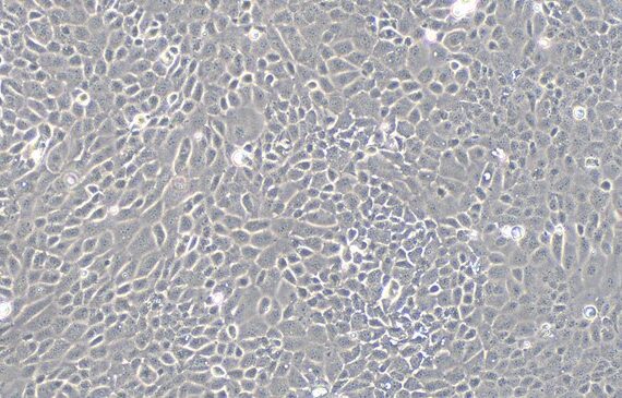 Primary Mouse Bladder Epithelial Cells (BEC)