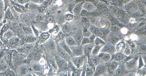 Primary Mouse Gastric Epithelial Cells (GEC)
