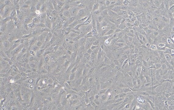Primary Rat Gastric Epithelial Cells (GEC)