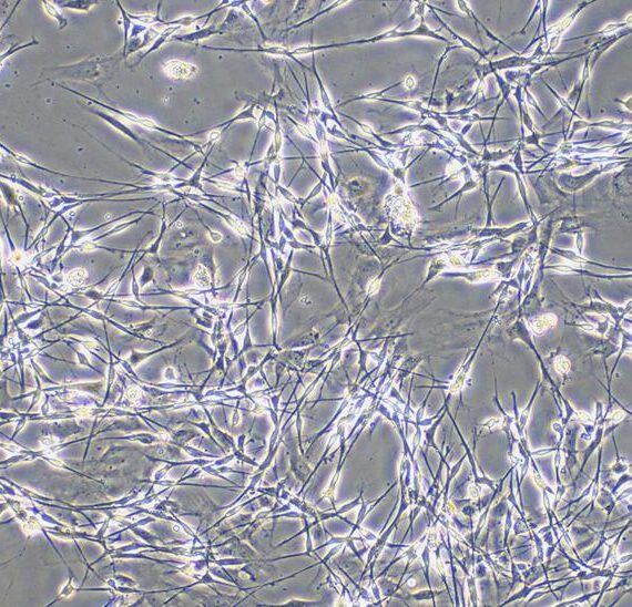 Primary Mouse Retinal Ganglion Cells (RGC)