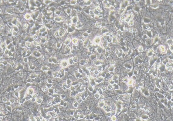 Primary Rat Retinal Ganglion Cells (RGC)