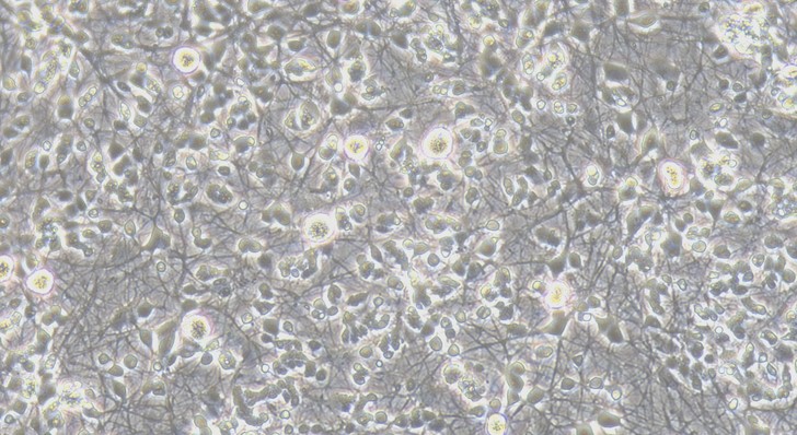 Primary Rat Retinal Ganglion Cells (RGC)