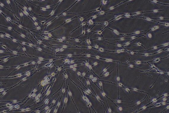 Primary Mouse Trigeminal ganglion neuron cells (TGN)