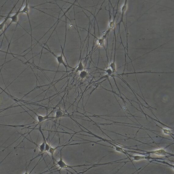 Primary Rat Trigeminal ganglion neuron cells (TGN)