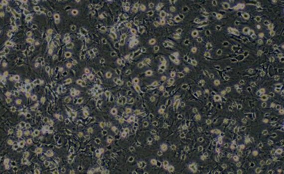 Primary Rat Spinal Cord Neuron (SCN)
