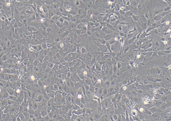 Primary Rat Spinal Cord Astrocytes (SCA)