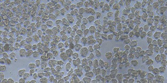 Primary Mouse Hepatocyte (Hep)