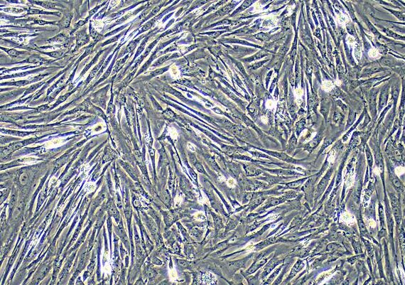 Primary Gallus Embryonic Fibroblasts (EF)