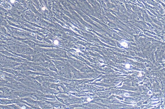 Primary Mouse Embryonic Fibroblasts (EF)