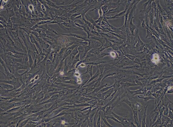 Primary Rat Embryonic Fibroblasts (EF)