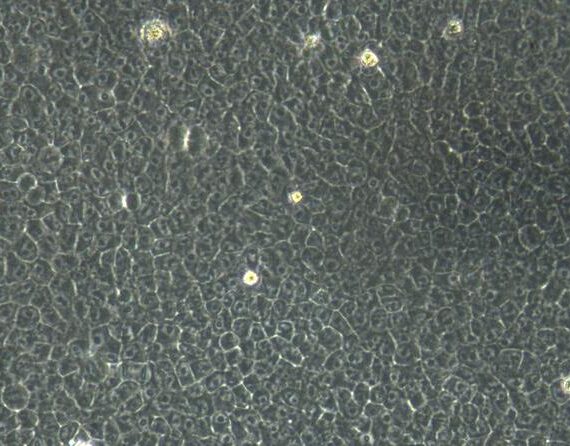 Primary Mouse Placental Mesenchymal Stem Cells (PMSC)