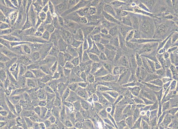 Primary Mouse Ovarian Granulosa Cells (OGC)