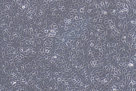 Primary Mouse Peritoneal Mesothelial Cells (PMC)
