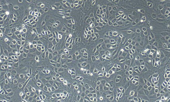Primary Rat peritoneal mesothelial cells