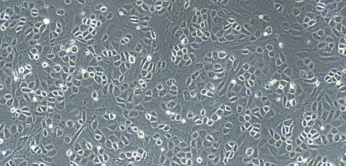 Primary Rat peritoneal mesothelial cells