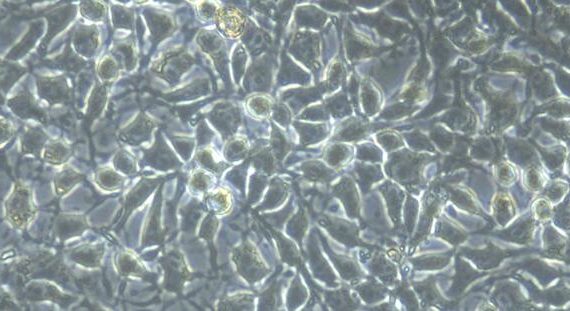 Primary Rabbit Peritoneal Mesothelial Cells (PMC)