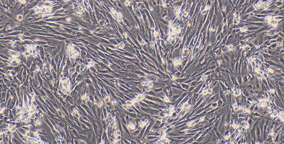 Primary Rabbit Ureteral Smooth Muscle Cells (USMC)