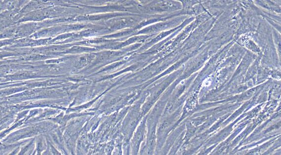 Primary Rabbit Ureter Smooth Muscle Cells (USMC