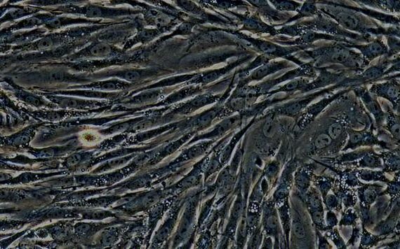 Primary Rabbit Urinary Tract Fibroblasts (UTF)