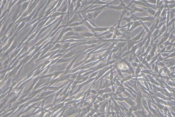 Primary Canine Corneal Stromal cells (CSC)