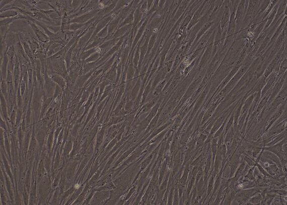 Primary Rabbit Corneal Stromal cells (CSC)