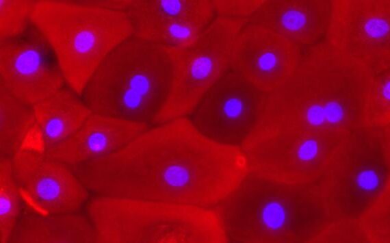 Primary Canine Ureteral Epithelial Cells (UEC)