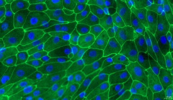 Primary Porcine Ureteral Epithelial Cells (UEC)