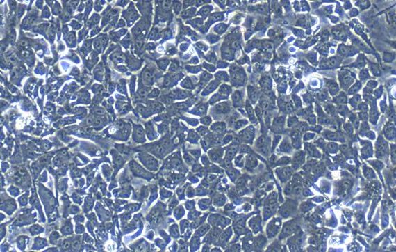 Primary Rabbit Ureteral Epithelial Cells (UEC)