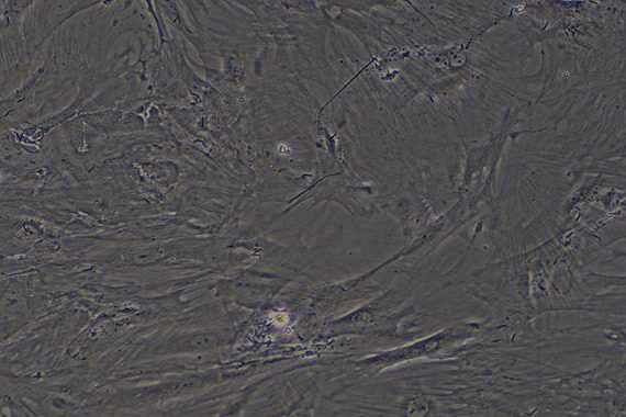 Primary Rat Epididymis Fibroblasts (EF)