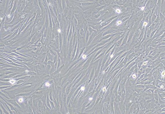 Primary Rabbit Small Airway Smooth Muscle Cells (SASMC)