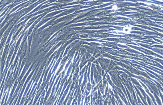 Primary Canine Pancreatic Fibroblasts (PNF)