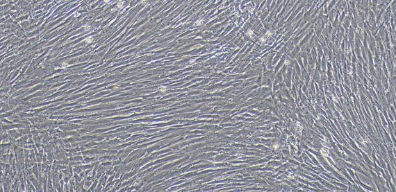 Primary Canine Corpus Cavernosum Smooth Muscle Cells (CCSM)