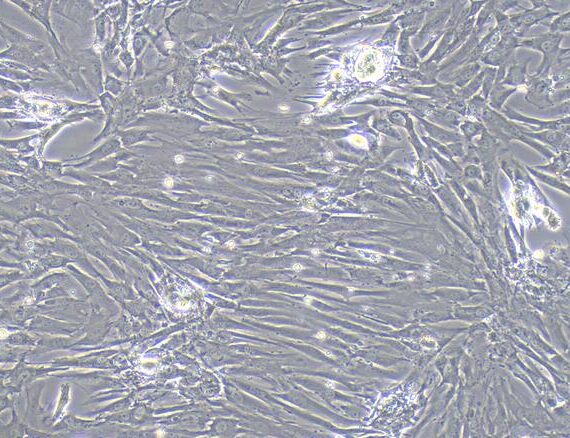 Primary Caprine Corpus Cavernosum Smooth Muscle Cells (CCSM)