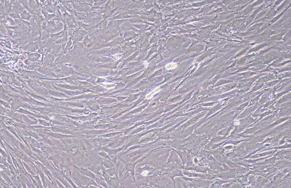 Primary Rat Corpus Cavernosum Smooth Muscle Cells (CCSM)