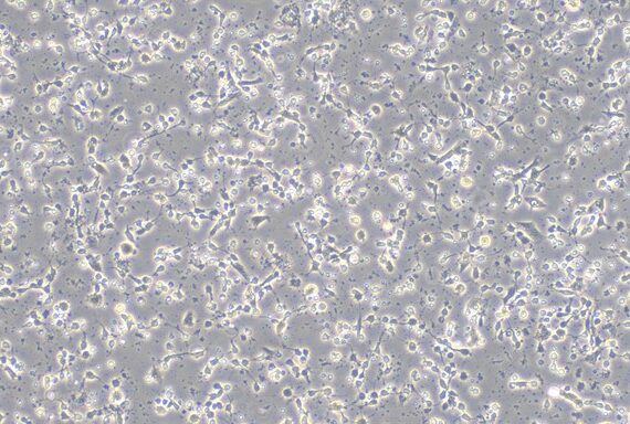 Primary Mouse Cerebral Cortex Neuron Cells (CCNC)