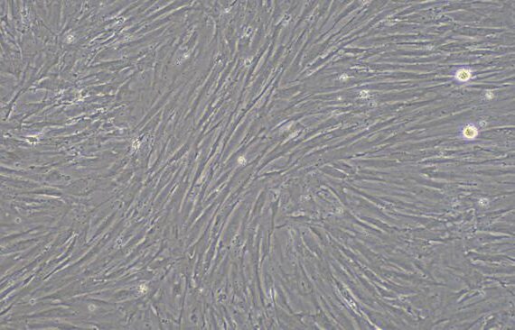 Primary Rat Vas Deferens Smooth Muscle Cells (VDSM)