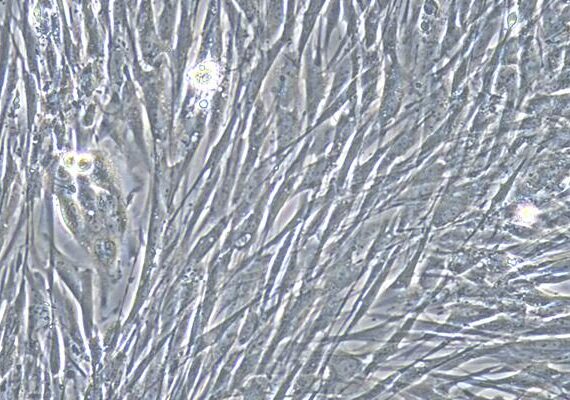 Primary Rabbit Vas Deferens Smooth Muscle Cells (VDSM)