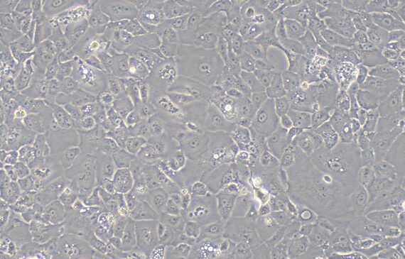 Primary Rabbit Vas Deferens Epithelial Cells (VDEC) (VDEC)