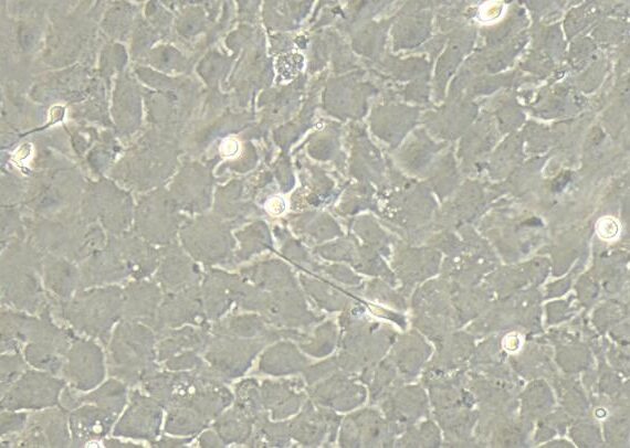 Primary Rat Olfactory Astrocytes (OA)