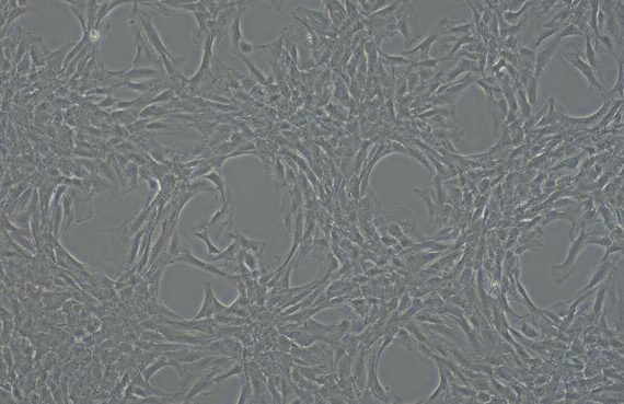 Primary Rat Femoral Artery Endothelial Cells (FAEC