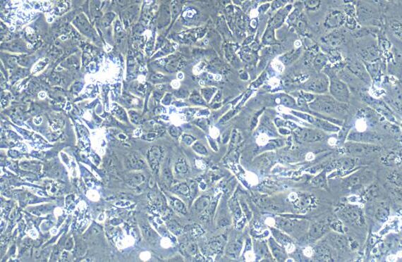 Primary Mouse Tubal Epithelial Cells (TuEC)