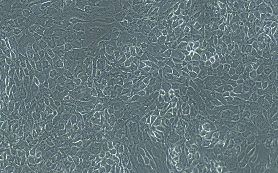 Primary Rabbit Tracheal Chondrocytes (TrC)
