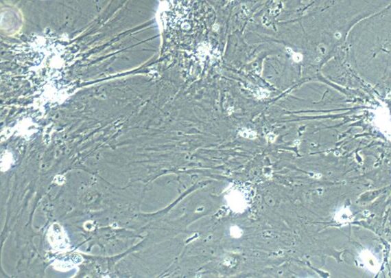 Primary Mouse Amniotic Mesenchymal Stem Cells (AMSC)