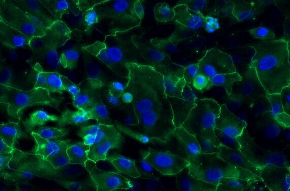 Primary Rabbit Vaginal Epithelial Cells (VEC)