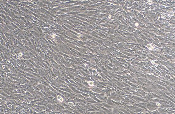 Primary Caprine Cardiac Valve Interstitial Cells (CVIC)