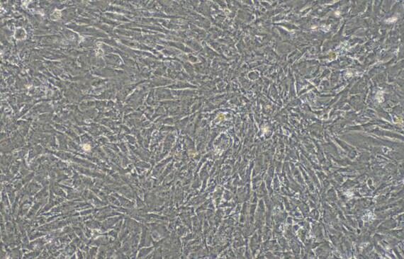 Primary Rabbit Cardiac Valve Interstitial Cells (CVIC)